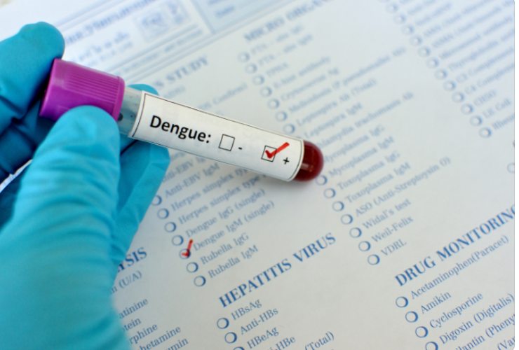 dengue sintomi